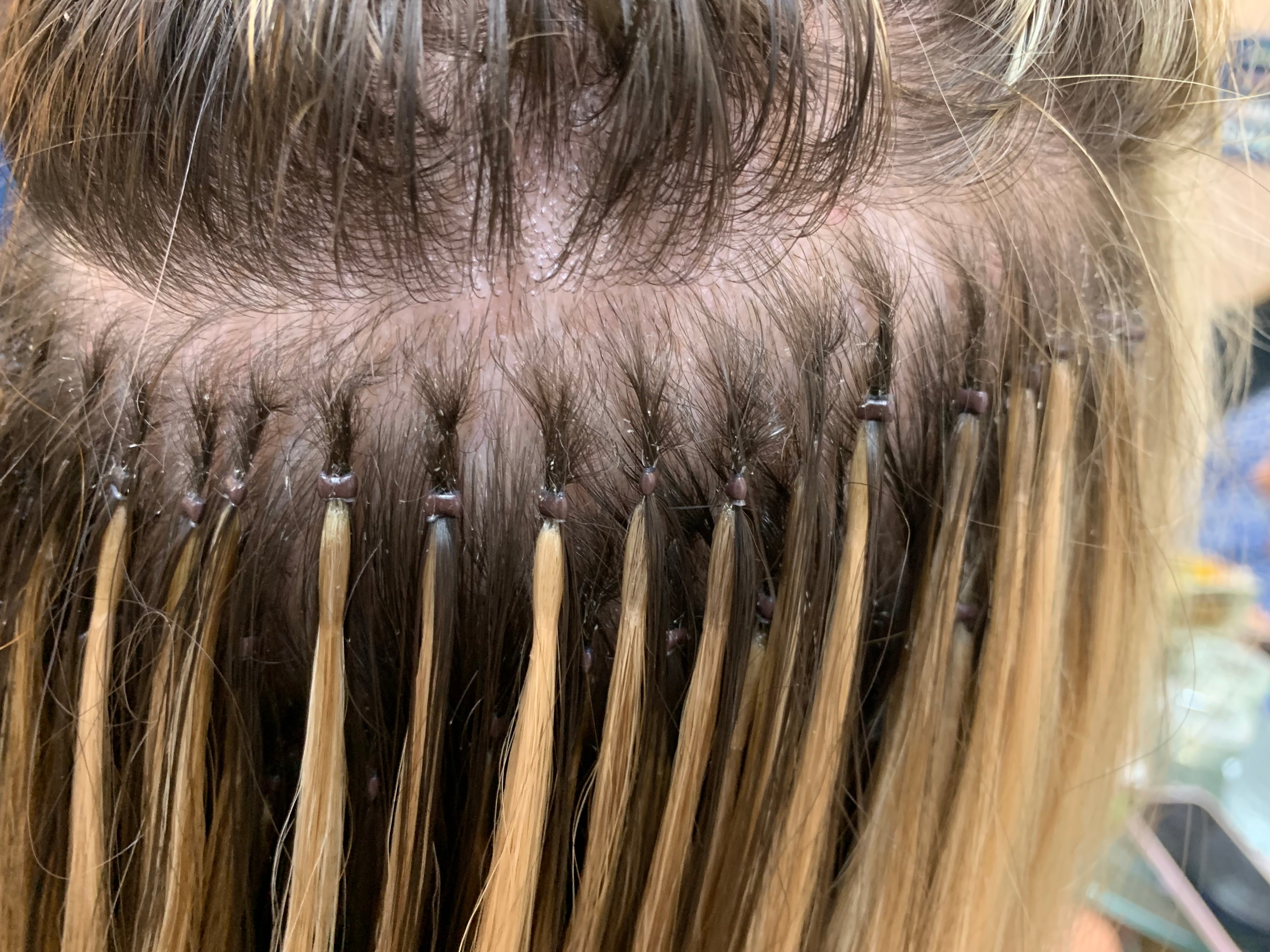 Extensions Removal