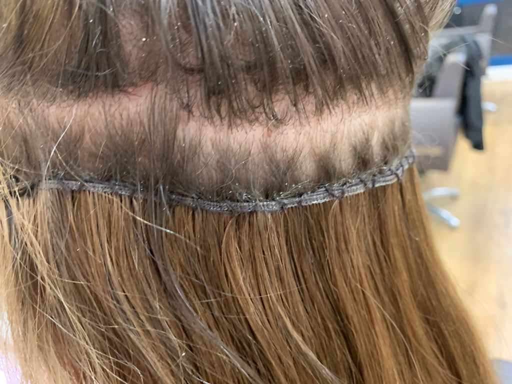 Extensions Removal