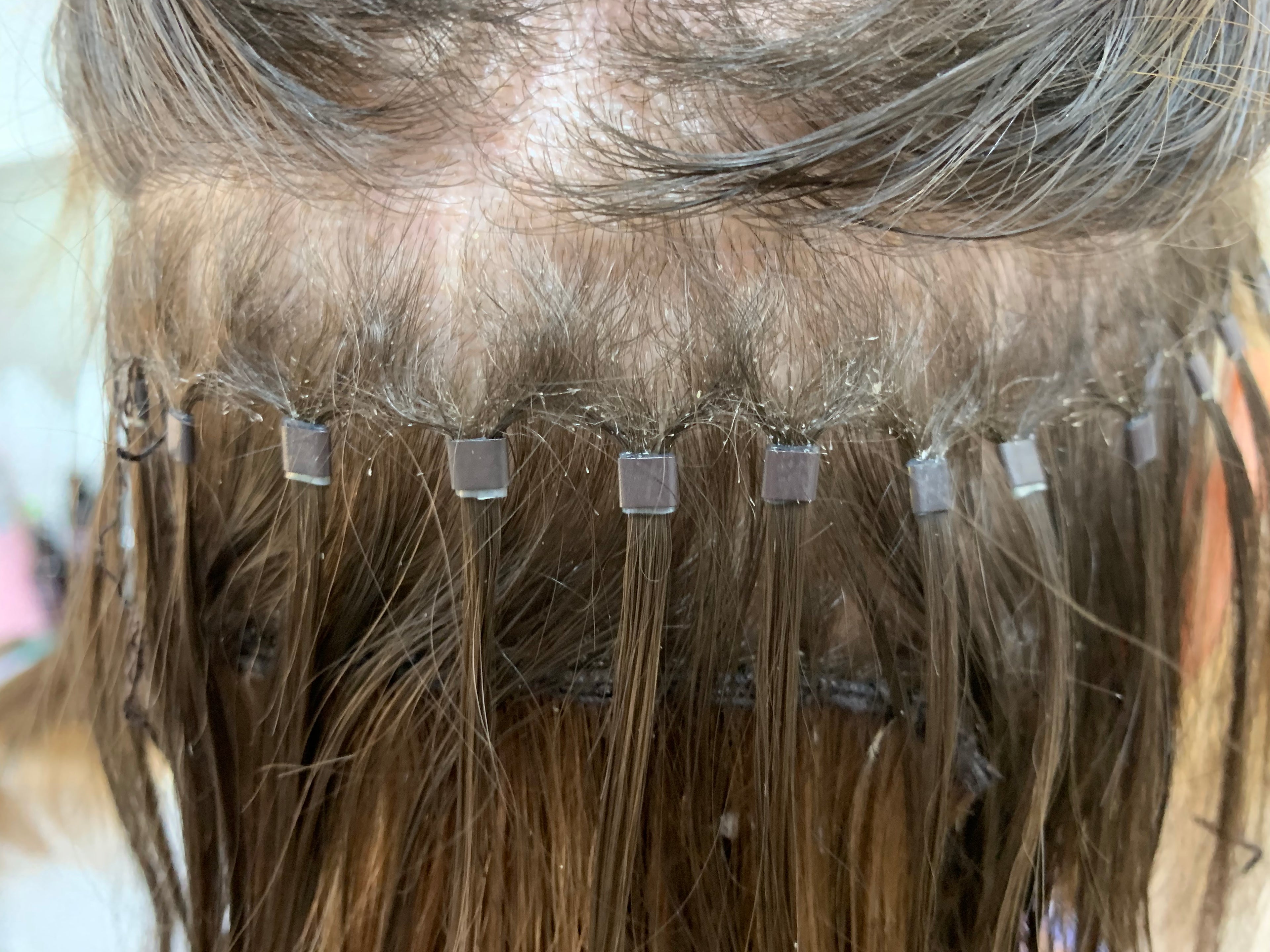 Extensions Removal